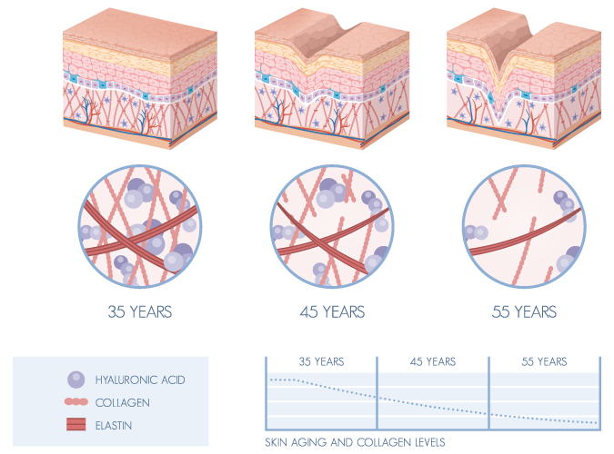 Causes Of Skin Aging