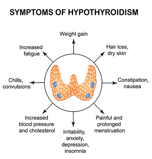 Symptoms Of Hypothyroidism